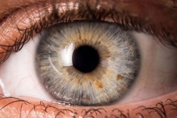 چشم ها طول عمر ما را پیش بینی می کنند!